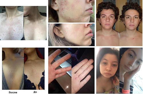 результат питание — копия.jpg