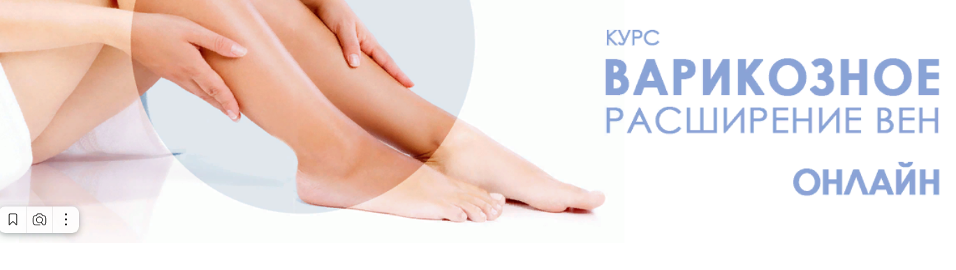Варикоз.png